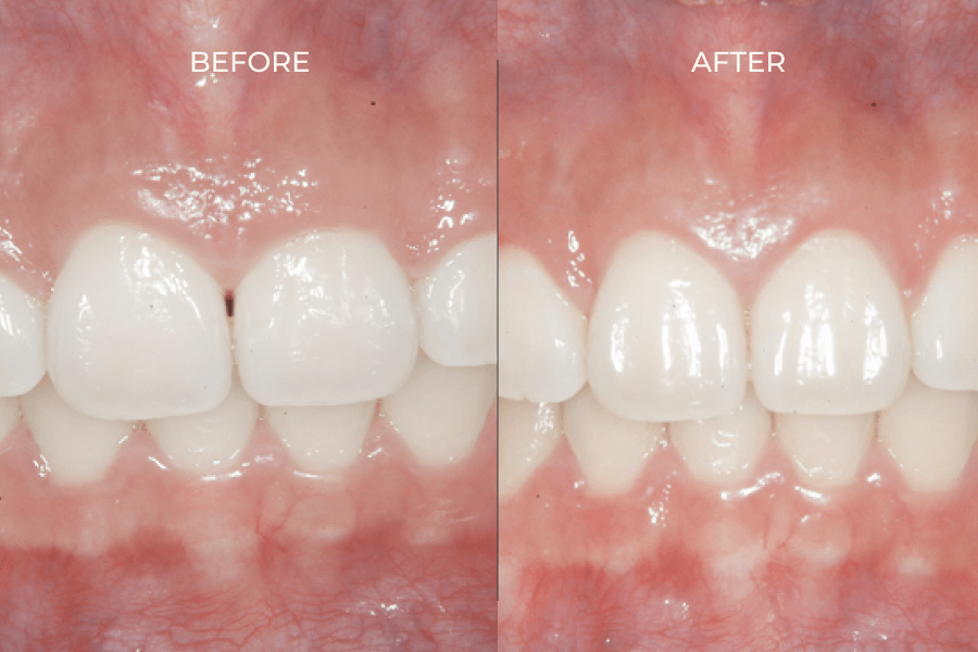 our service Dental Design Clinic & Lab Asoke, Bangkok High